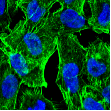 Confocal image of AN3-CA cells
